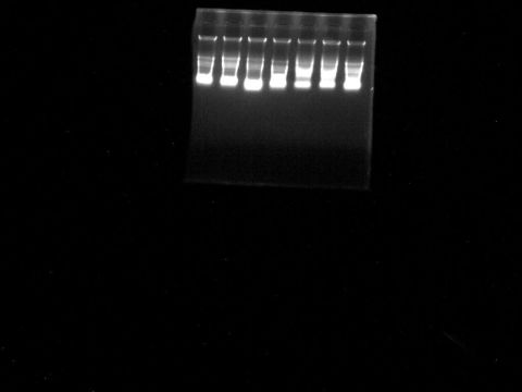 DNA的提取和电泳实验报告